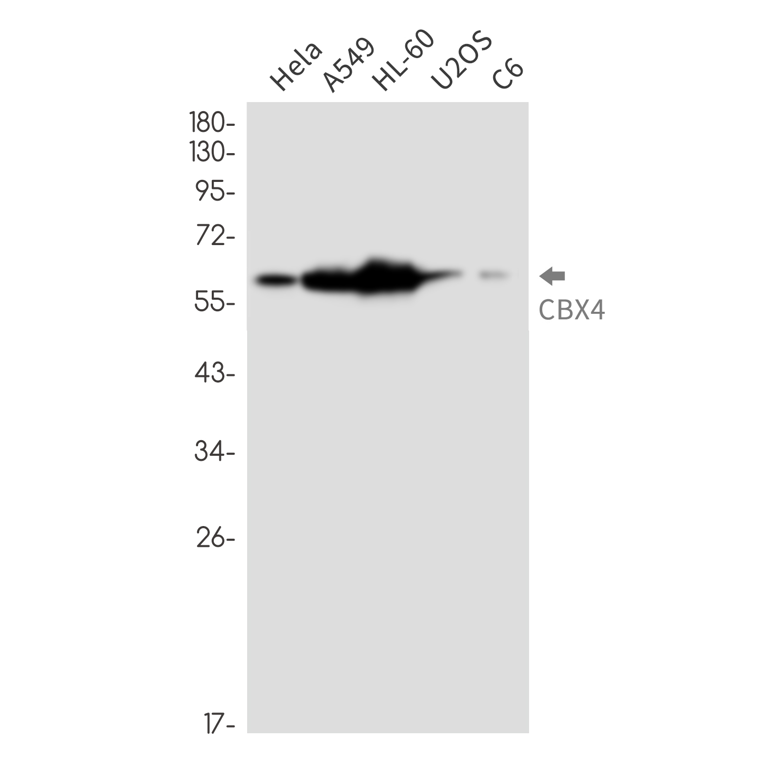 CBX4 Rabbit mAb